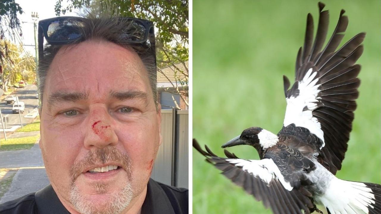 ‘Stab’ wound: Swooping bird leaves real estate agent bleeding