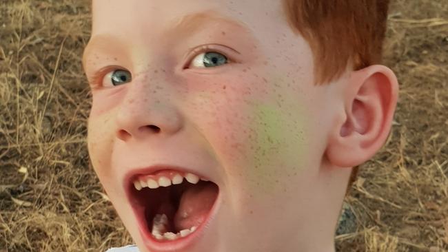 Supplied copy pictures of 6yr old Michael Schipanski who was attacked by a dingo while holidaying on Fraser Island with family