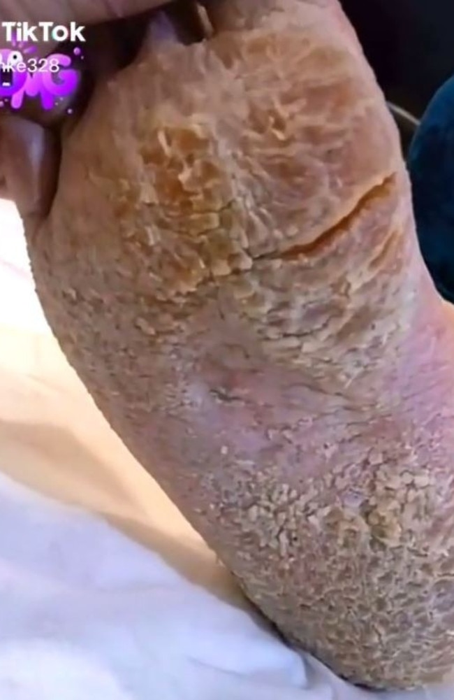 Gross moment beautician shaves off mountains of dry skin on client's feet, video