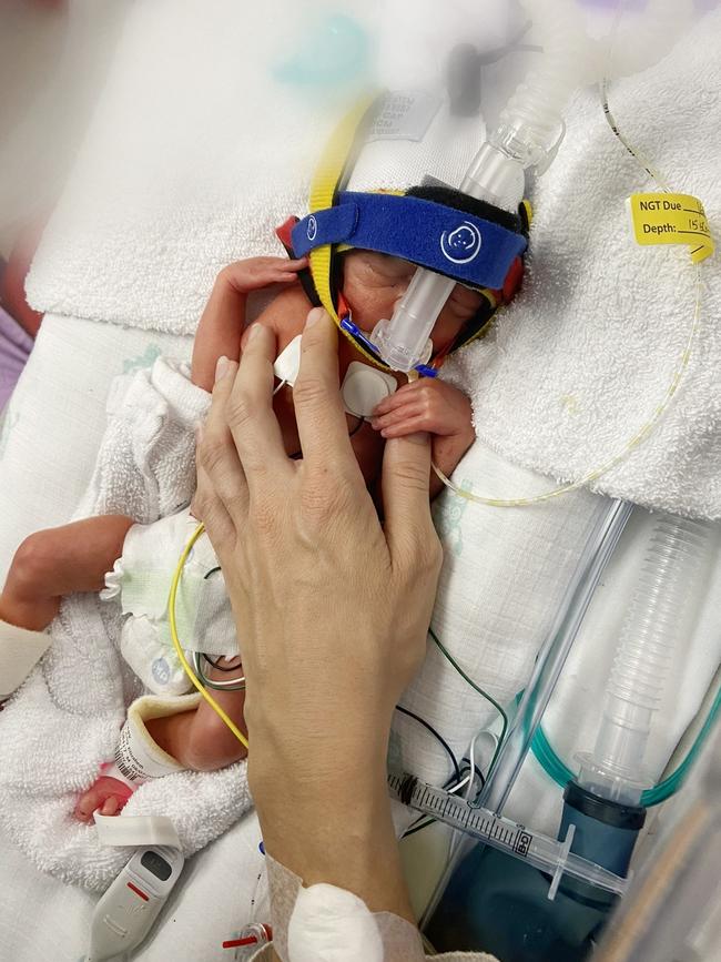 Samuel Beasy was born premature at 27 weeks.