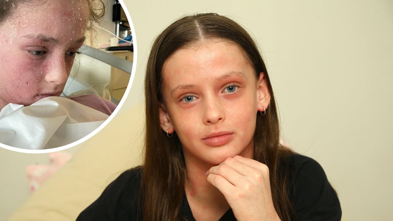 Ipswich Pre Teen Allergic To Her Own Tears The Advertiser 1117