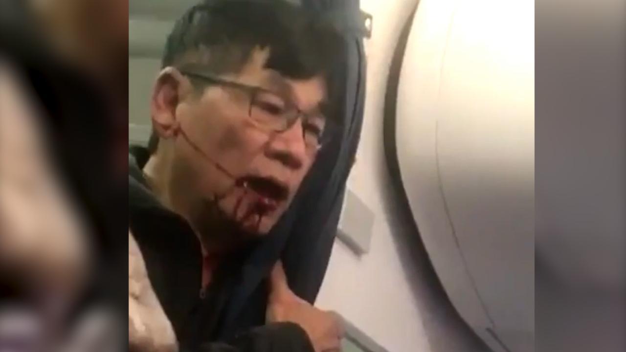 Bloodied Passenger Dragged Off Overbooked United Flight at Chicago O'Hare