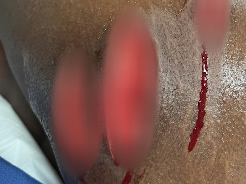 A teenage boy was repeatedly slashed in the knee during a violent assault in Werribee last year. Picture: Supplied