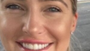 ‘No idea’: Woman’s bizarre Pfizer side effect