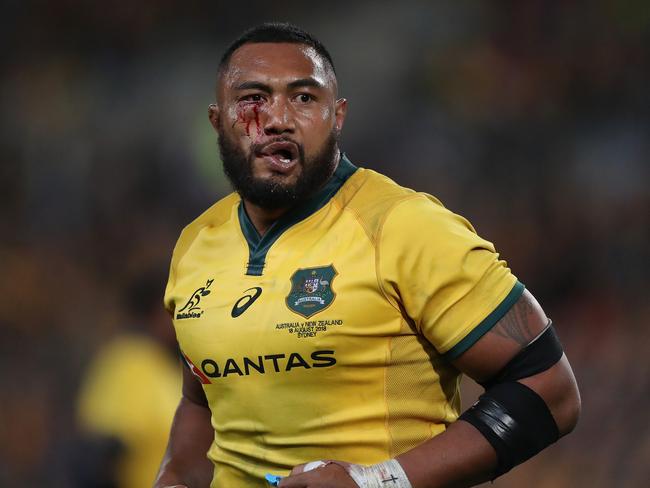 Australia's Sekope Kepu required stitches to a cut under his right eye after the Bledisloe Cup match at ANZ Stadium. Picture: Brett Costello