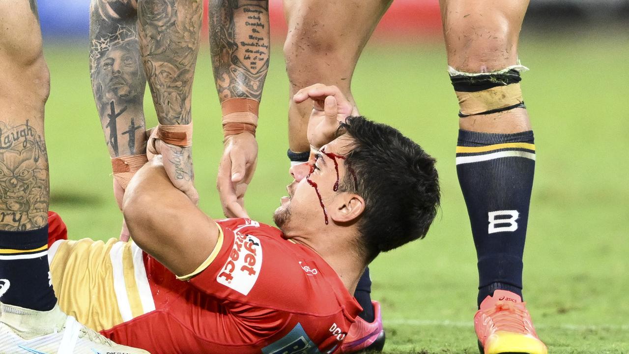 Kodi Nikorima was forced from the field after a nasty friendly fire head collision. Picture: NRL Images.