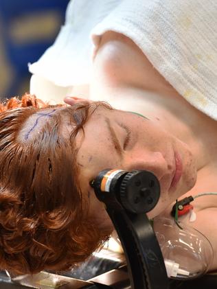 Brave teens undergo brain surgery — while they're still awake | Daily  Telegraph