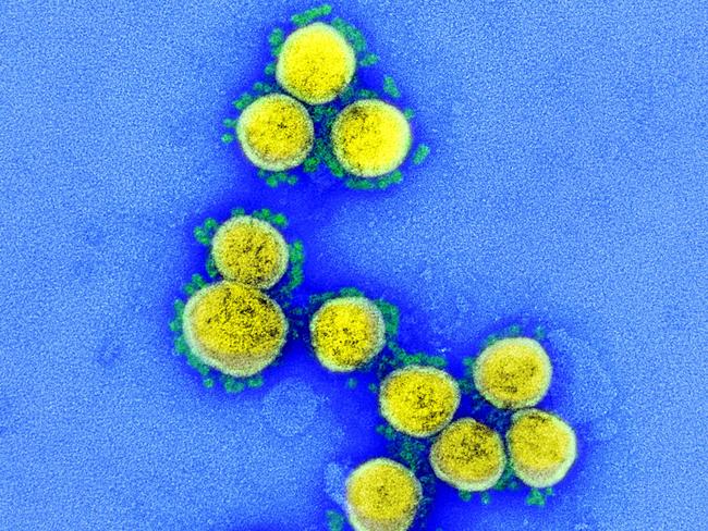 This undated handout image obtained August 11, 2020, courtesy of the National Institute of Allergy and Infectious Diseases(NIH/NIAID), shows a ransmission electron micrograph of SARS-CoV-2 virus particles, isolated from a patient, captured and color-enhanced at the NIAID Integrated Research Facility (IRF) in Fort Detrick, Maryland. - Although none of the coronavirus vaccines under development has proved its efficacy yet in clinical trials, at least 5.7 billion doses have been pre-ordered around the world. First shipments of a COVID-19 vaccine created by Western laboratories have often been snapped up by the United States.Five vaccines -- three Western and two Chinese -- are in Phase 3 efficacy trials involving thousands of people.In a surprise announcement, Russian President Vladimir Putin claimed on August 11, 2020 that a vaccine dubbed "Sputnik V" -- after the Soviet satellite -- conferred "sustainable immunity" against the novel coronavirus. (Photo by Handout / National Institute of Allergy and Infectious Diseases / AFP) / RESTRICTED TO EDITORIAL USE - MANDATORY CREDIT "AFP PHOTO /NATIONAL INSTITUTE OF ALLERGY AND INFECTIOUS DISEASES/HANDOUT " - NO MARKETING - NO ADVERTISING CAMPAIGNS - DISTRIBUTED AS A SERVICE TO CLIENTS