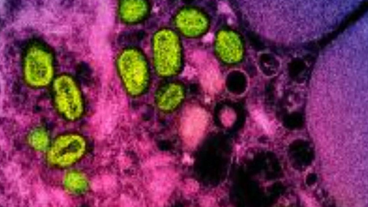 'Dangerous’ virus has now spread past Africa﻿