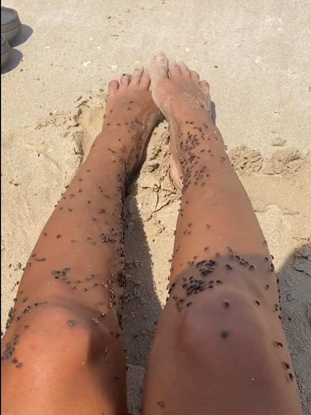 The couple described the flies as “next level” and mentioned the issue was more manageable in Exmouth, an hour and a half to the north. Picture: TikTok/ our_aussielap