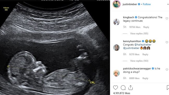 Justin Bieber pranks fans by announcing his wife, Hailey is pregnant on April Fools’ Day @justinbieber