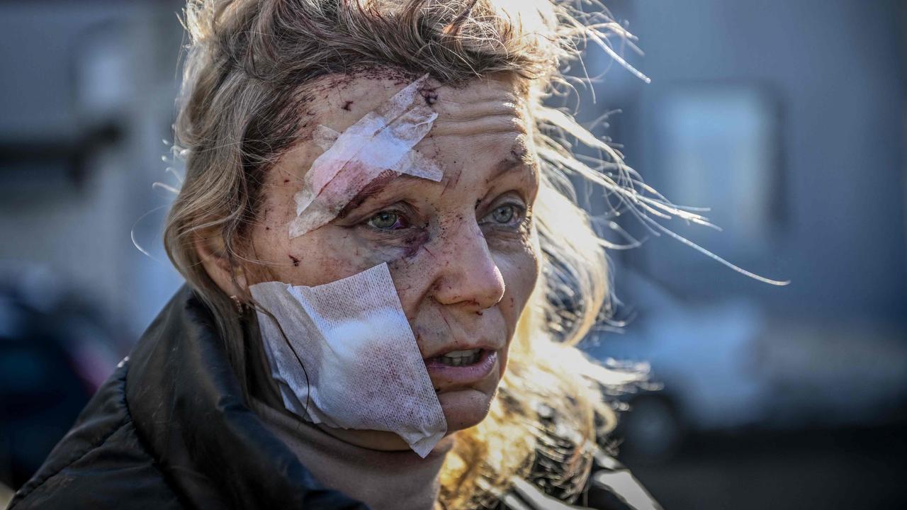 Helena, a 53-year-old teacher, stands outside a hospital after the bombing of the eastern Ukraine town of Chuguiv on February 24. Picture: Aris Messinis/AFP