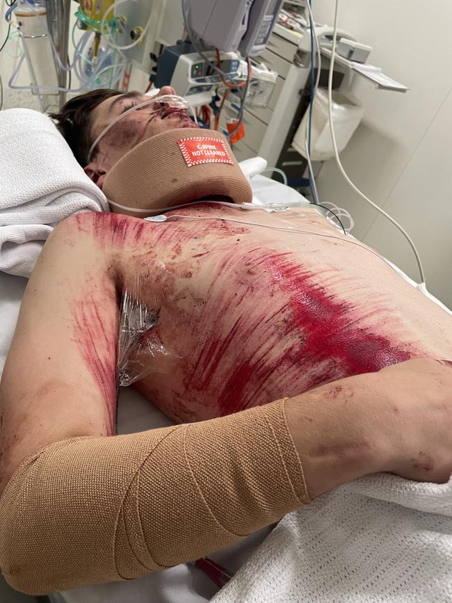 Aaron Tremul in hospital after he was struck from behind on his bike and almost killed. Picture: Supplied