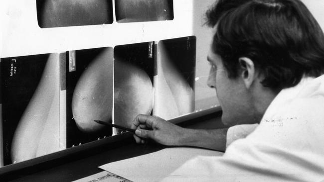 A pathologist inspects an X-ray for signs of breast cancer. File photo. Picture: Supplied.