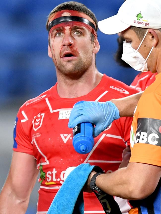 The bloody aftermath for McCullough. Pictures: NRL Photos