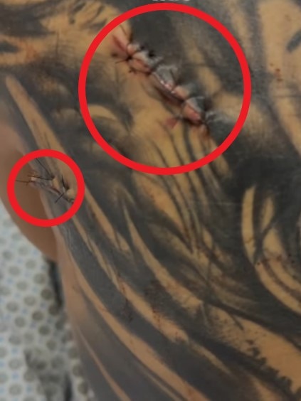 The attack came after she dumped her boyfriend. Photo: Instagram