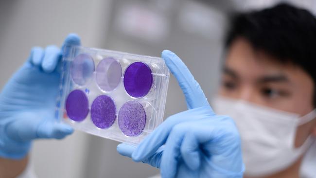 A researcher works on virus replication in Belo Horizonte, Brazil. That country has a deal to produce up to 100 million doses of the coronavirus vaccine being developed by Oxford University. Picture: AFP