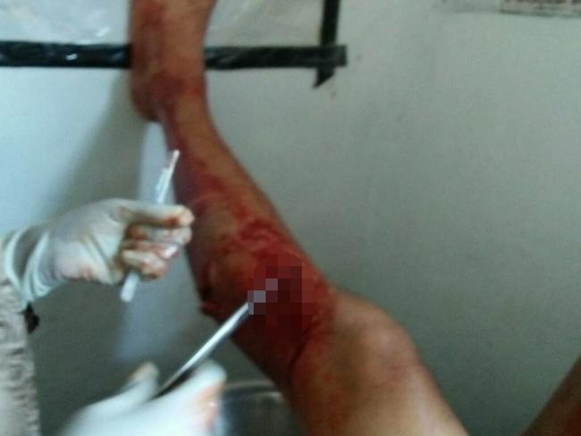 Singaporean tourist Lon Lee Alle was mauled by a Komodo dragon in Indonesia. Picture: Viral Press