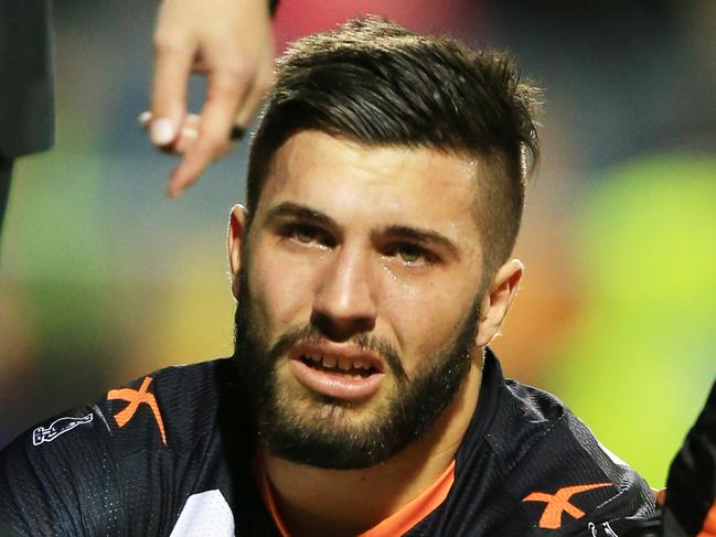 James Tedesco with a shattered knee cap during the NRL round 16 game between the Wests Tigers and the Canberra Raiders at Campbelltown Stadium, Campbelltown. pic Mark Evans