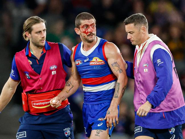 Liberatore leaves the field against Hawthorn. (Photo by Dylan Burns/AFL Photos via Getty Images)