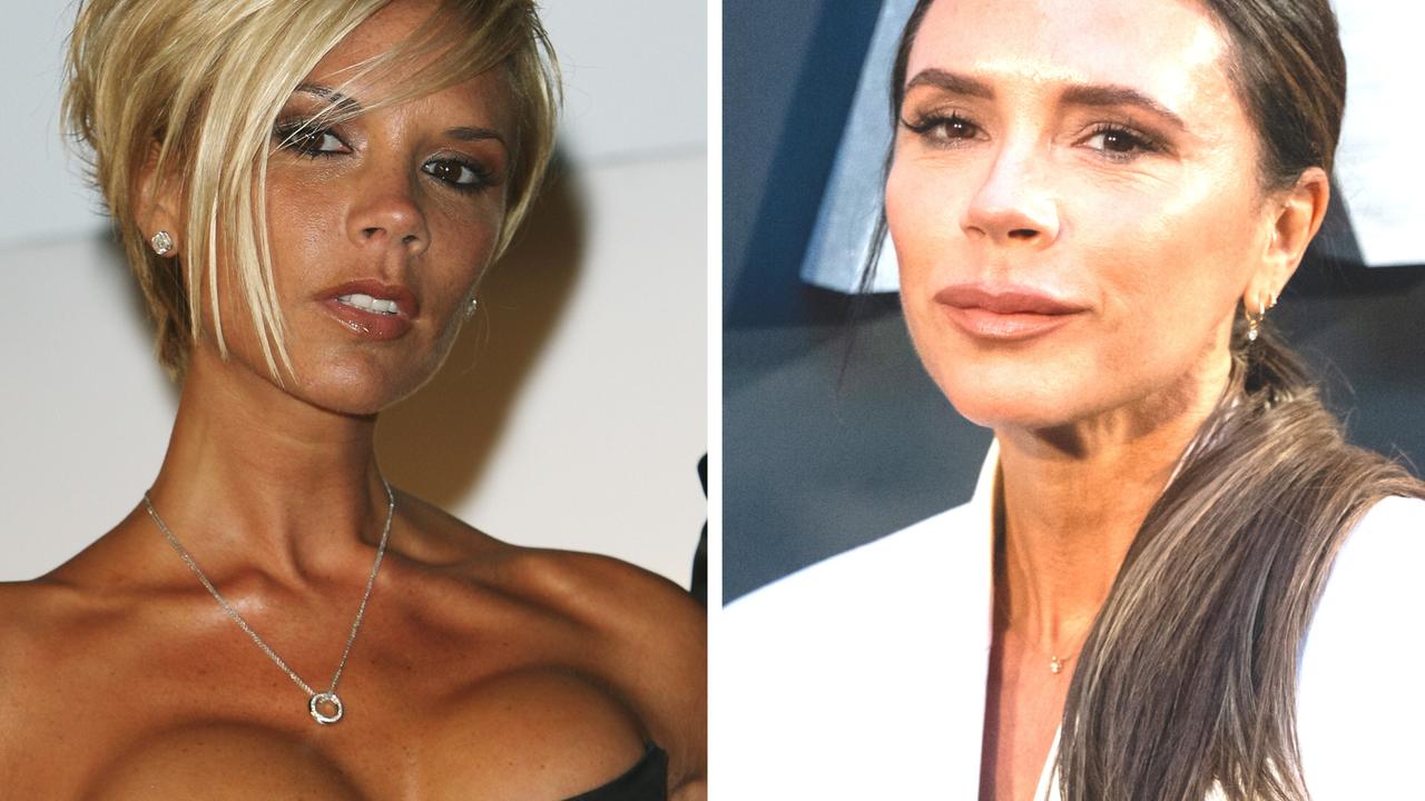 Victoria Beckham is speaking about her plastic surgery.