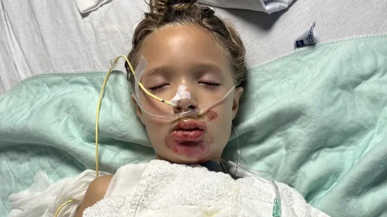 TikTok challenge leaves girl, 7, in a coma