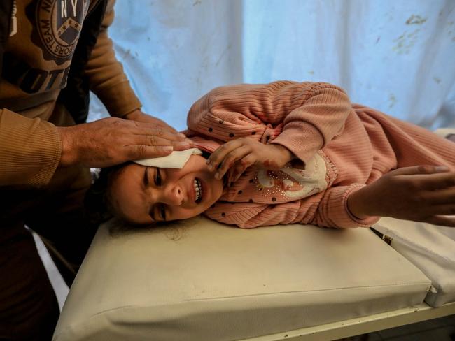 A Palestinian child injured in an Israeli air strike receives treatment at Nasser Medical Hospital in Khan Younis, Gaza. Picture: Getty Images
