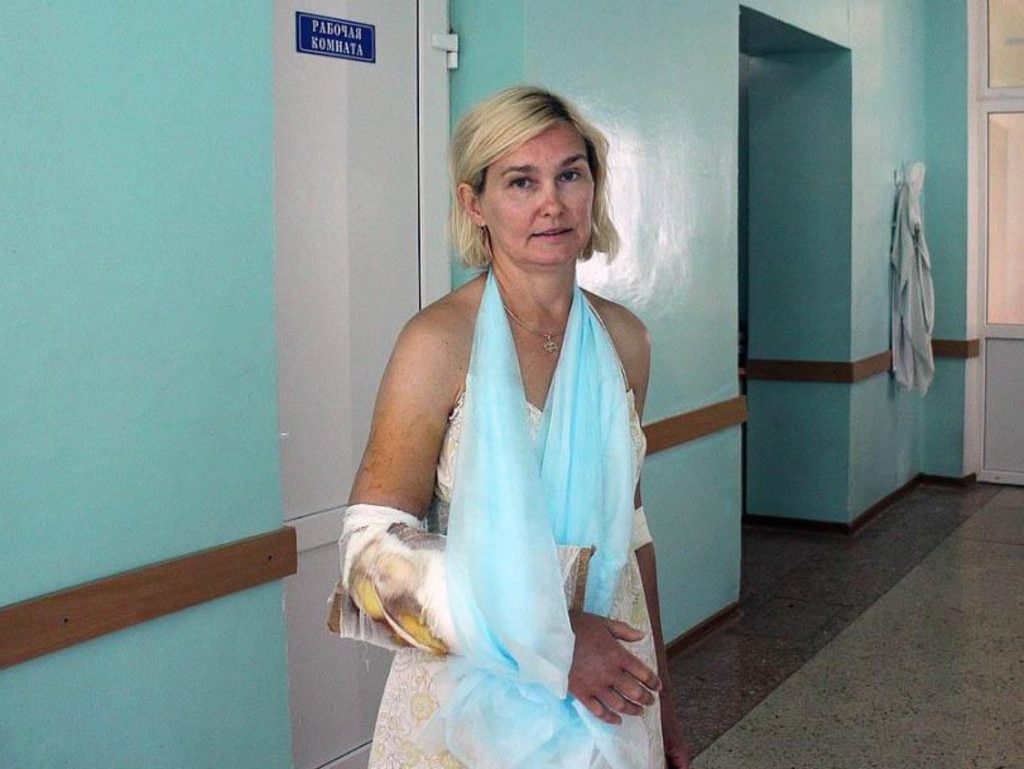 Olga Solomina was mauled by a lion at the Taigan Safari Park in Crimea. Picture: East 2 West News