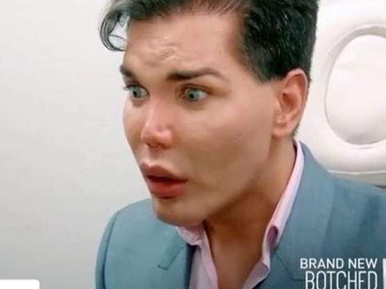 Rodrigo Alves has had more surgery. Picture: Rodrigo Alves/Instagram