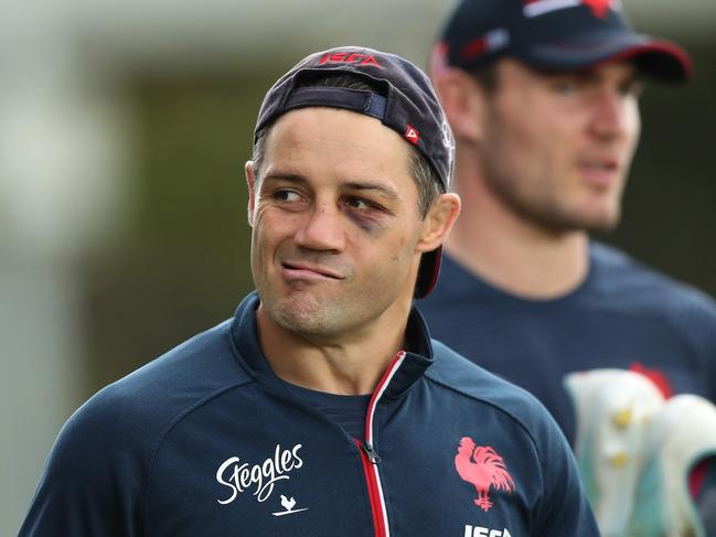 Cooper Cronk sports a black eye at Moore Park ahead of the Roosters' clash with Melbourne at the SCG on Saturday. Picture: Brett Costello