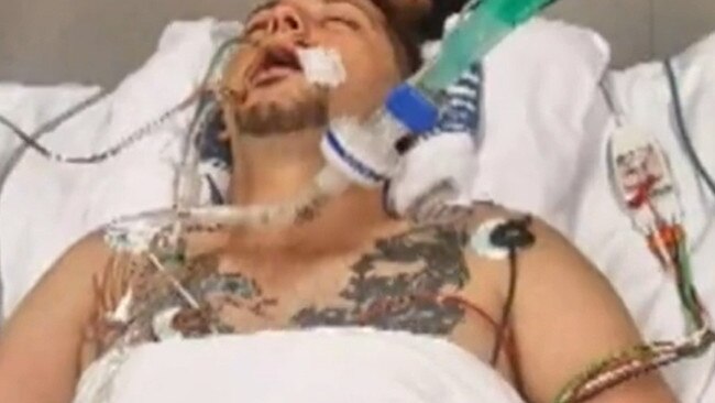 Supplied Editorial Adam Whetstone was left with serious injuries after an assault last month. Picture: 9 News