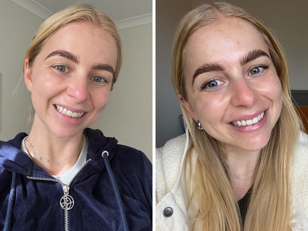 My skin before and after. Definitely got more of a glow and skin is more hydrated. Picture: Hannah Paine/news.com.au.