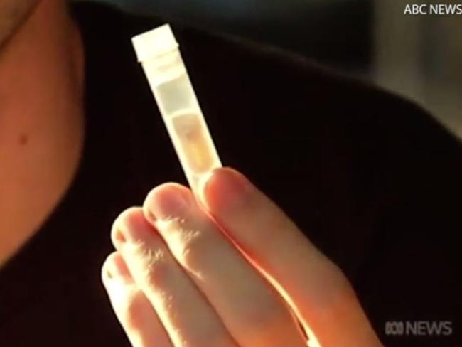 The chip was inserted by a piercing expert and took around an hour. Picture: ABC News