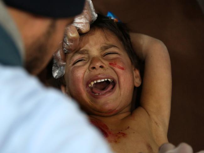 A child cries as he receives treatment at a makeshift hospital in Kafr Batna after being wounded with his mother in government air strikes in the town of Jisreen. Picture: Ammar Suleiman/AFP