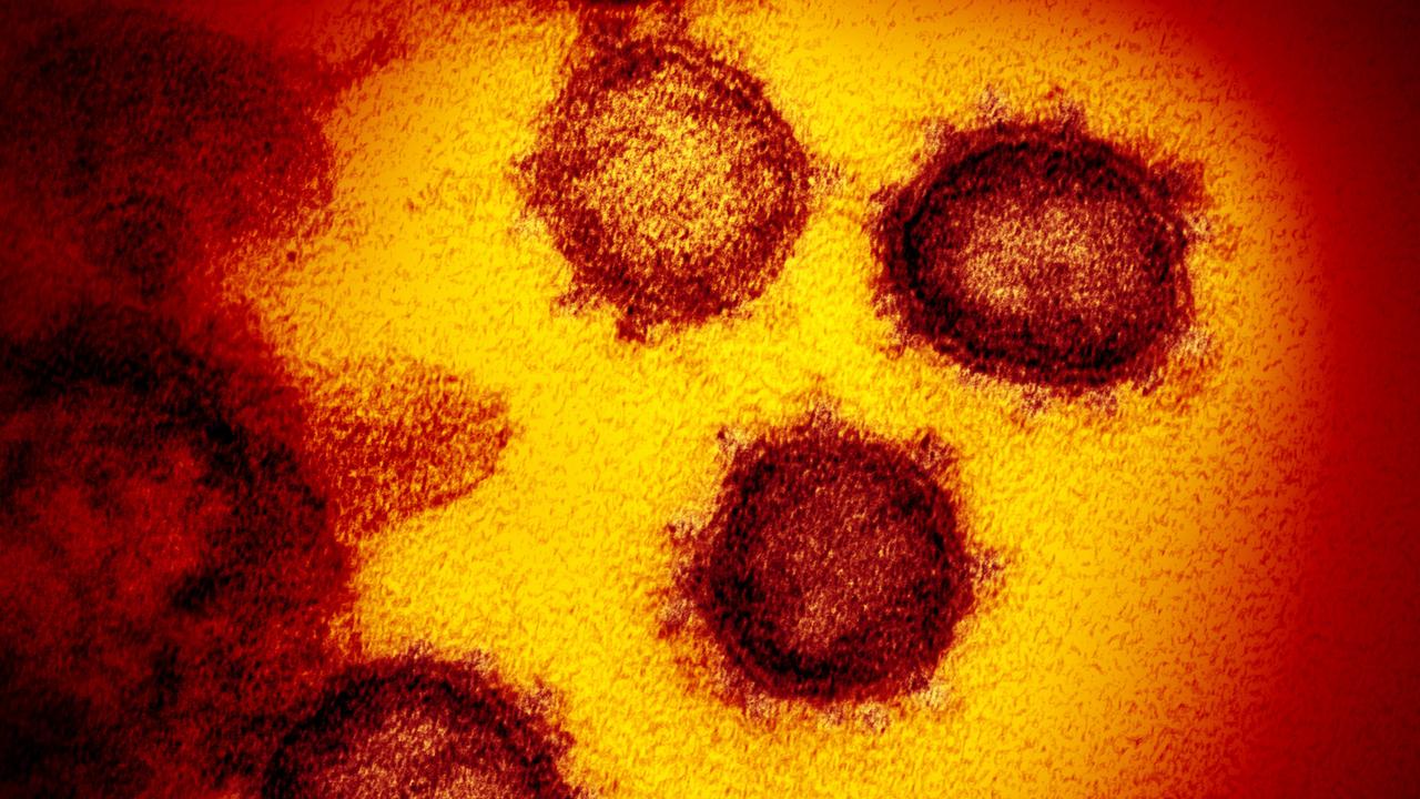 An electron microscope image of the Novel coronavirus SARS-CoV-2. Picture: NIAID-RML via AP.