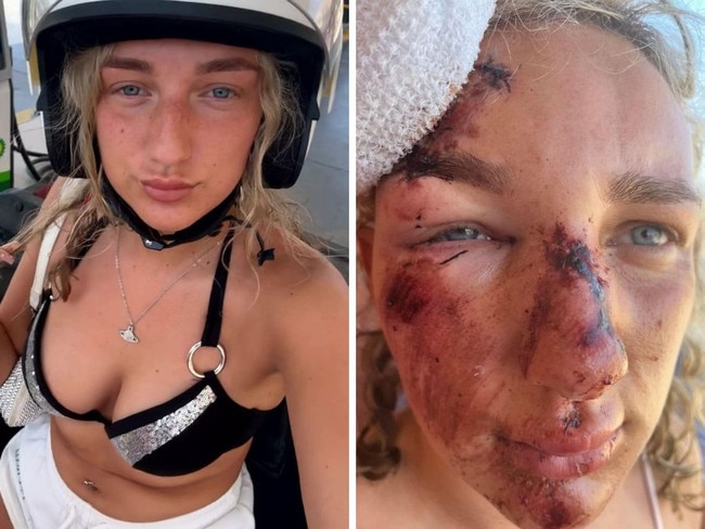 Holly Thomas was struck by a car while on a quad bike. Picture: Kennedy News & Media