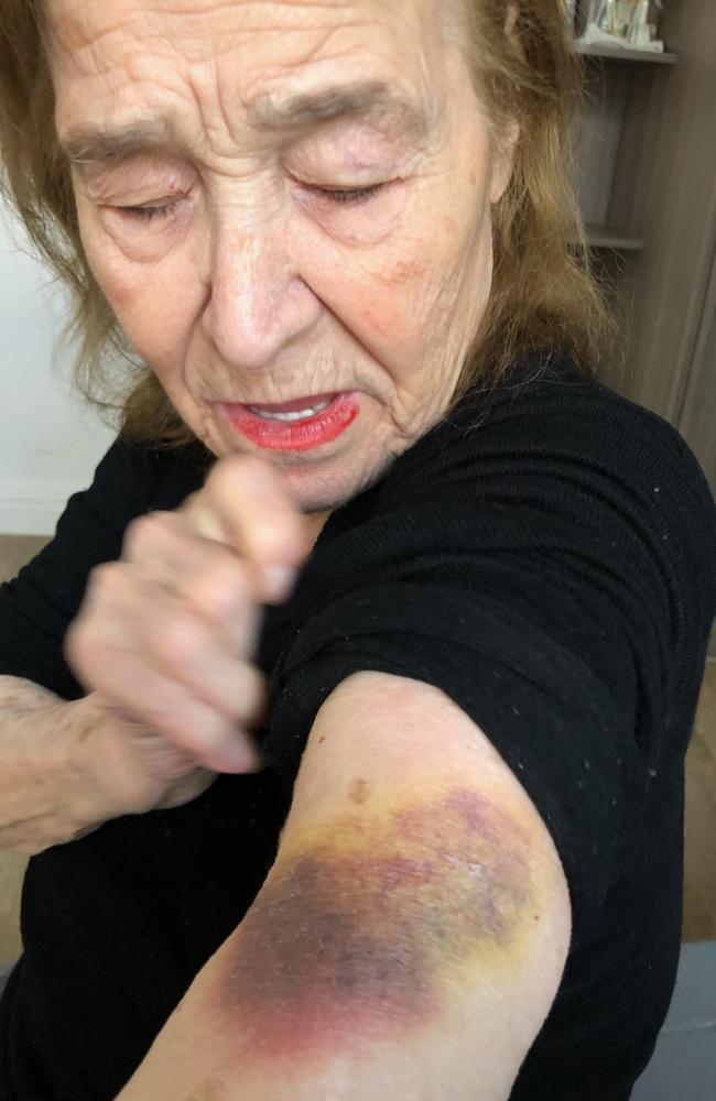 Georgia Tzintzions, 80, was allegedly assaulted by another patient at Bupa Seaforth aged care home. Picture: Supplied