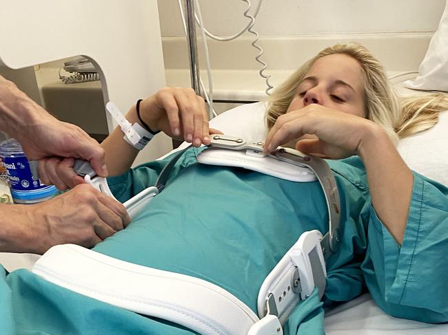 Surfer Sophie McCulloch in hospital with a broken back after a surf accident.