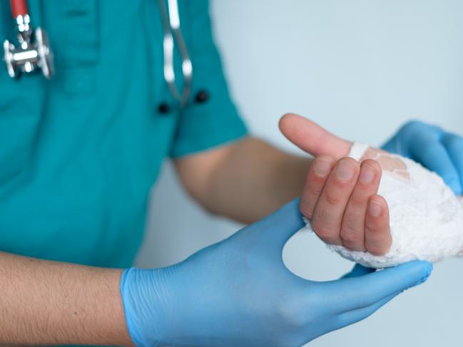 Close up of doctor bandaging one hand after an accident