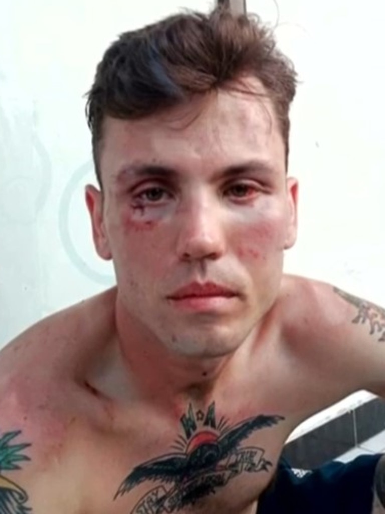 Australian Matt Stevenson has been bashed in Bali. Picture: Supplied / 7 News