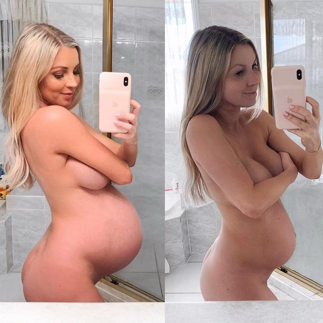 Instagram: Model shares 'real' naked photos of before and af