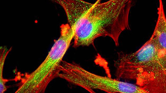 Microscope enlargement of Mesenchymal stem cells, which are capable of forming other organ cell types, including cancerous cells. 