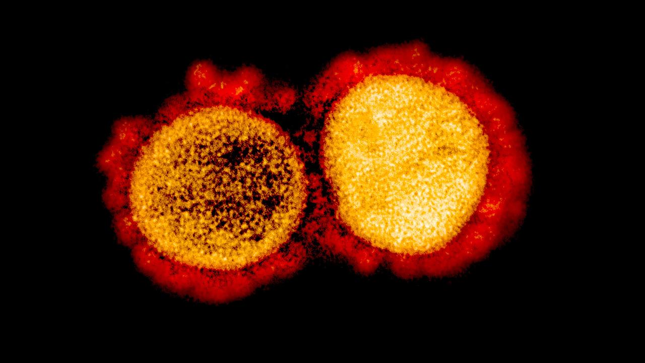 A transmission electron micrograph of SARS-CoV-2 virus particles. Picture: AFP