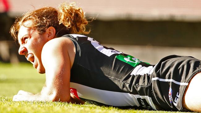 Collingwood midfielder Tim Broomhead is expected to miss up to a year after breaking his leg. Picture: Getty Image