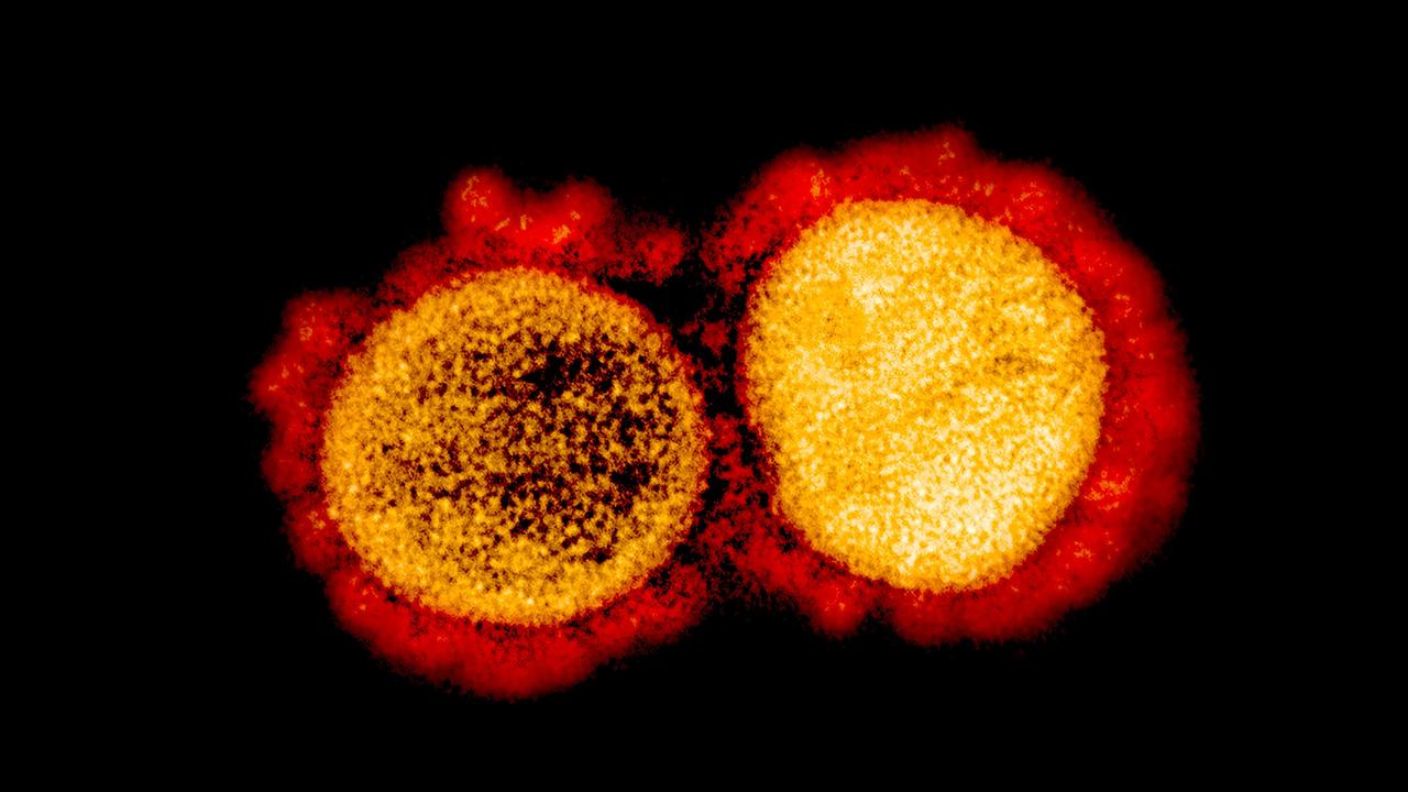Russia says the first batch of its vaccine is ready.