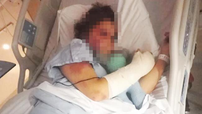 A 13-year-old girl allegedly held against her will and tortured by three teenagers at Tewantin, Sunshine Coast, last month is now being guarded around the clock. Source: GoFundMe