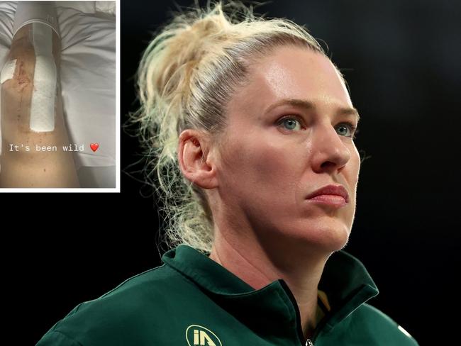 Lauren Jackson has undergone knee surgery.