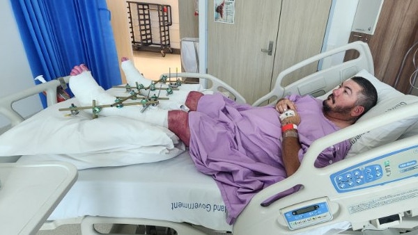 Jason Taylor was working on a client's garden when he fell through a roof landing on both ankles, shattering them. He is looking at six months recovery. Photo supplied by Lisa Adams
