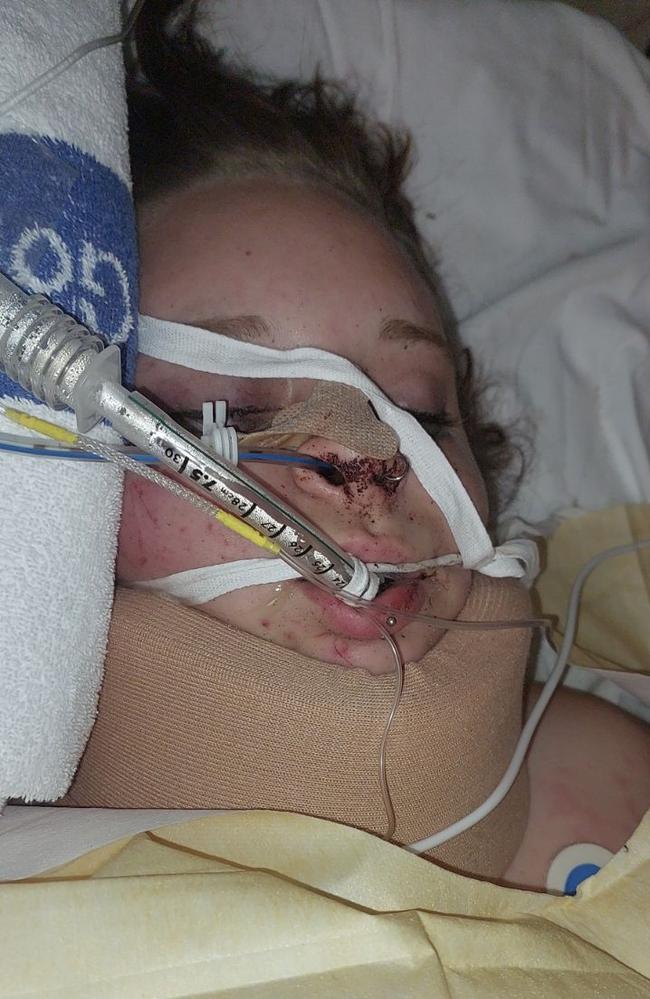 By the time Cody arrived staff had administered four bags of blood, cut off Mia’s clothes and enveloped her body in a heated trauma blanket; 