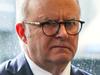 How negative gearing rules would affect you